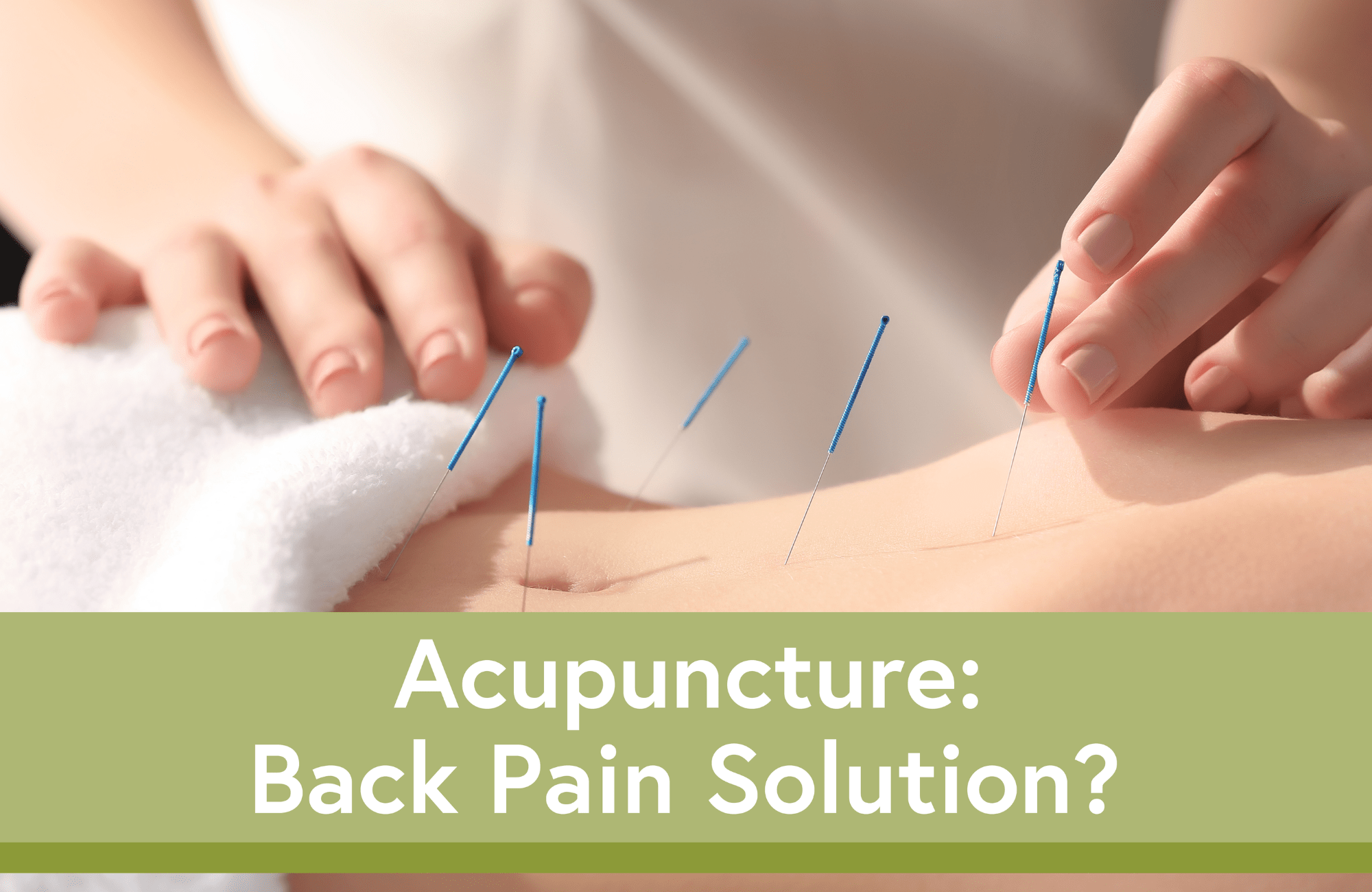 Can Acupuncture Help Treat Back Pain?